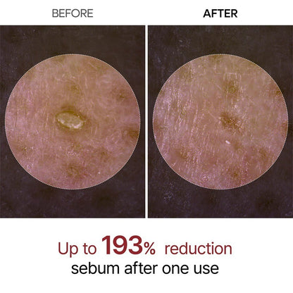 Beautymaris™ Peel Shot